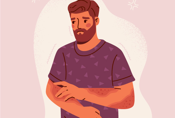 Illustration von einem Mann mit Gürtelrose